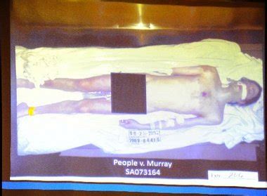 michael jackson autopsy photo|Shocking pics of Michael Jacksons body shown at trial